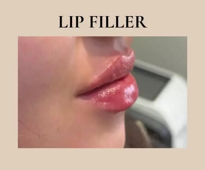 lips-before-after-eleven-eg-aesthetic-service-in-mayfield-heights-oh