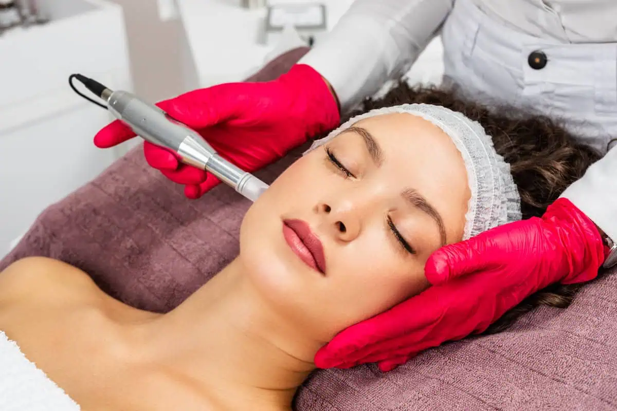 microneedling-by-eg-aesthetics-in-mayfield-heights-oh